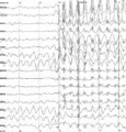 Thumbnail for version as of 14:16, 28 January 2015