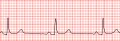 Thumbnail for version as of 15:36, 28 January 2015