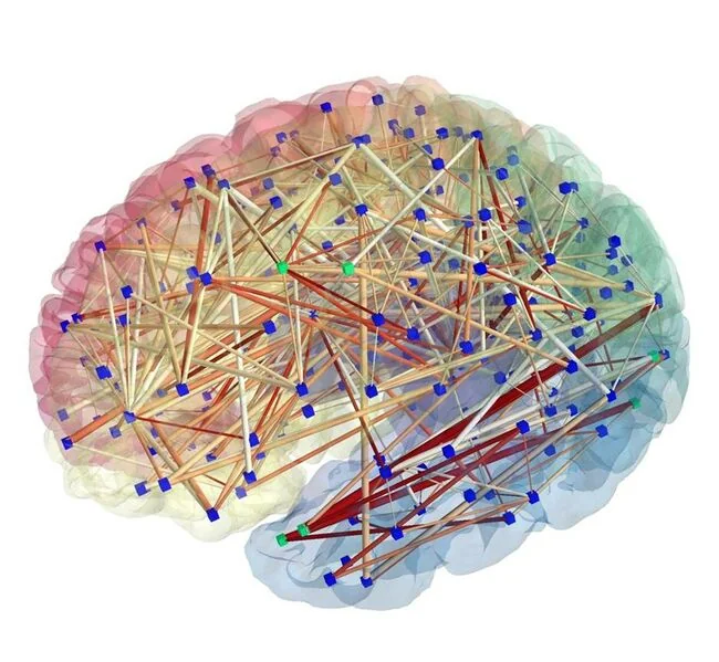File:Brain connectivity.jpg