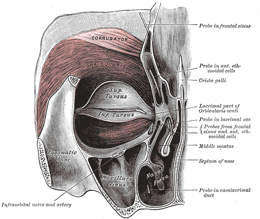 File:Blepharospasm.png